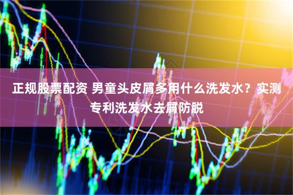 正规股票配资 男童头皮屑多用什么洗发水？实测专利洗发水去屑防脱